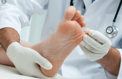 Home Remedies for Athletes Feet