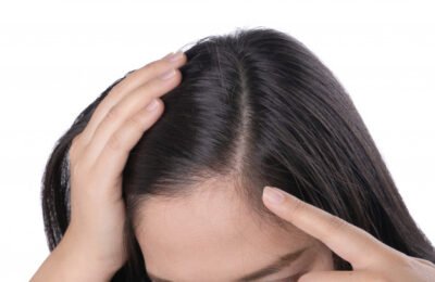4 Effective Hair Loss Tips